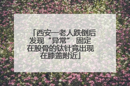 西安一老人跌倒后发现“异常” 固定在股骨的钛针竟出现在膝盖附近